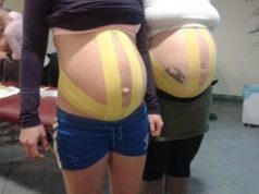 Taping az Egészség kuckóban!