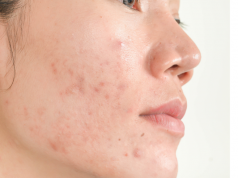 A BŐRÖD IS JELZI HA A BELSŐD NINCS RENDBEN